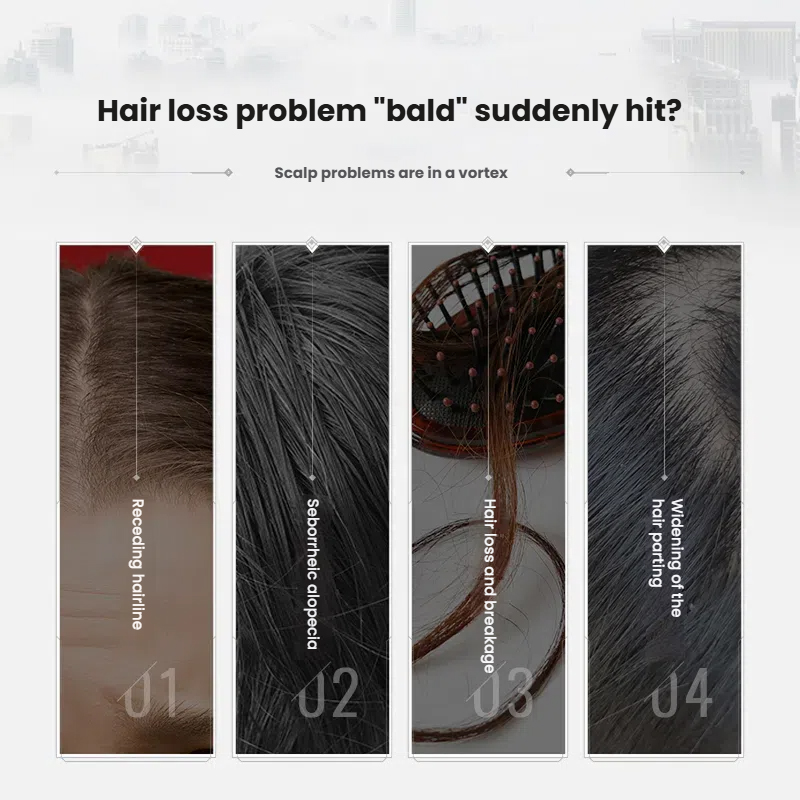 Buzhilin Herbal Anti-Hair Loss Strengthening Root Shampoo